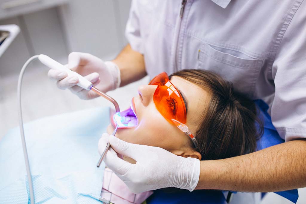 5 recomendaciones que debes tomar en cuenta al realizarse un blanqueamiento dental