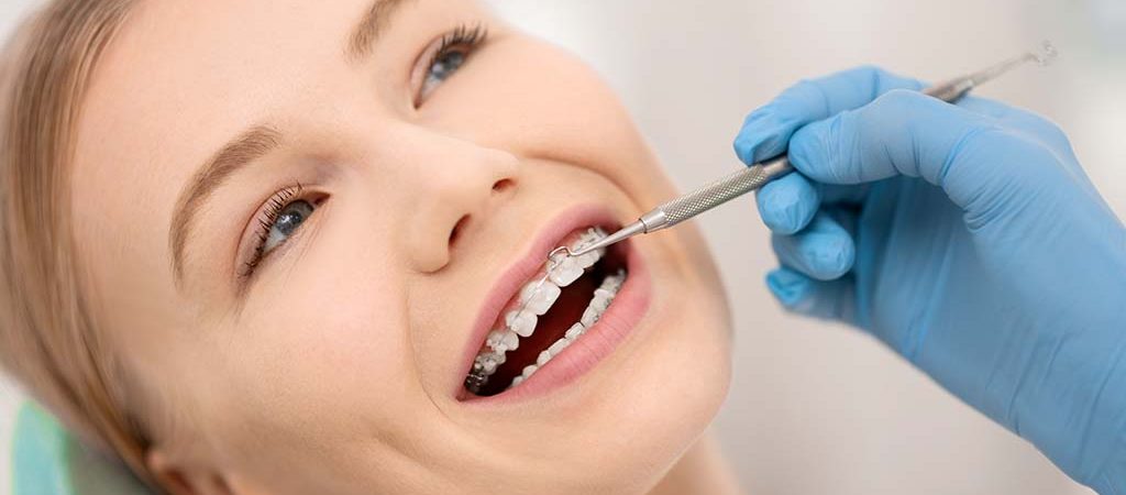 6 preguntas frecuentes antes de realizarse un proceso de ortodoncia