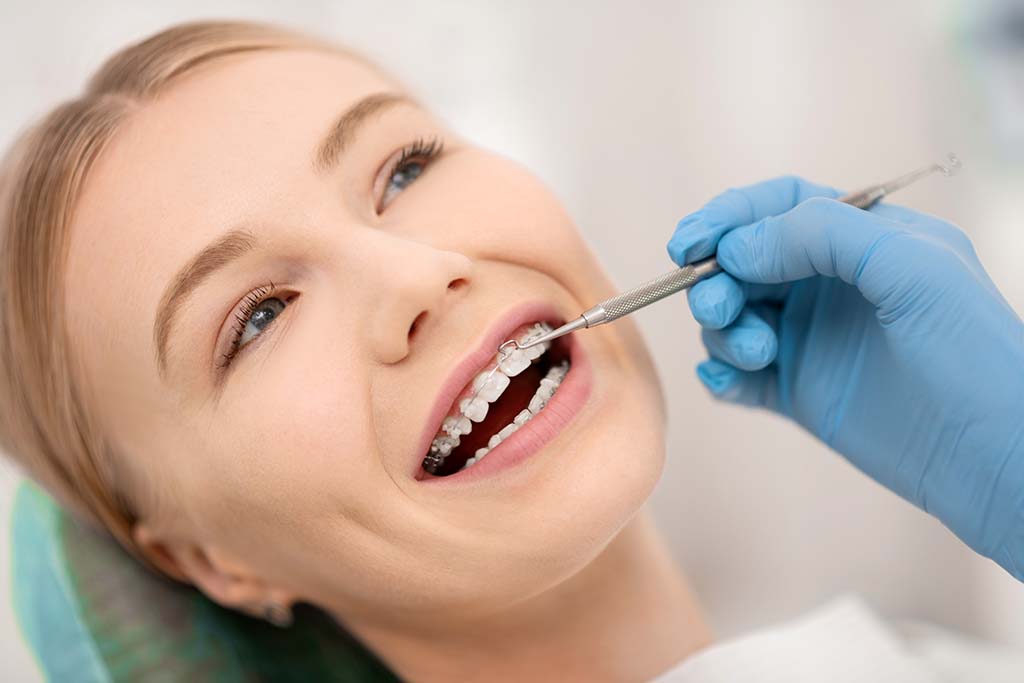 6 preguntas frecuentes antes de realizarse un proceso de ortodoncia