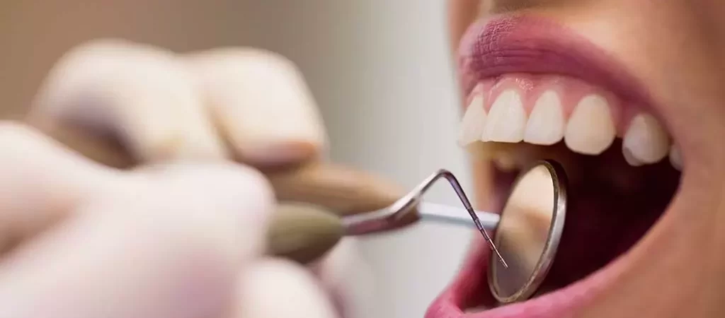 Qué es la resina dental y en qué casos se utiliza -