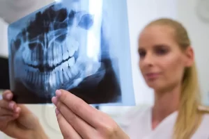Radiografías digitales intraorales