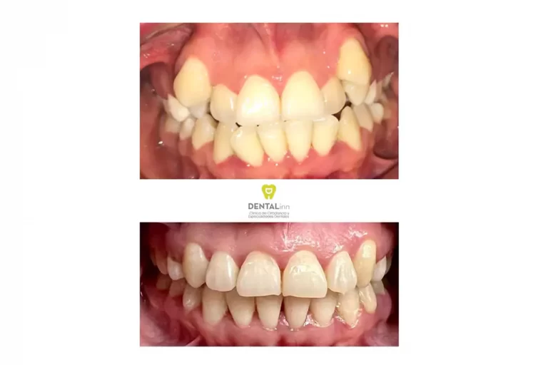 tratamiento de ortodoncia
